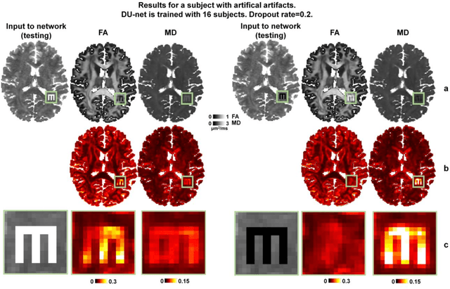 Figure 3 for Quantifying the uncertainty of neural networks using Monte Carlo dropout for deep learning based quantitative MRI