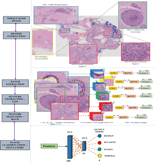 Figure 3 for Bag of Visual Words (BoVW) with Deep Features -- Patch Classification Model for Limited Dataset of Breast Tumours