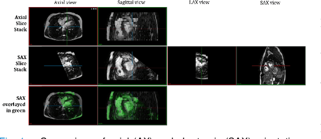 Figure 1 for Unsupervised Domain Adaptation from Axial to Short-Axis Multi-Slice Cardiac MR Images by Incorporating Pretrained Task Networks