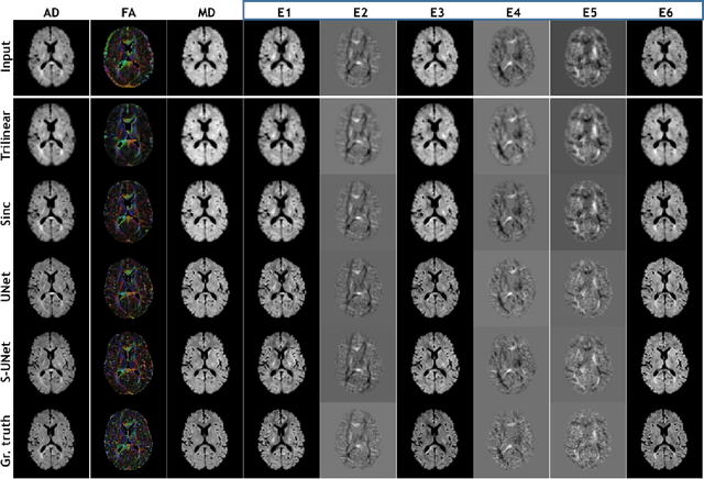 Figure 3 for ShuffleUNet: Super resolution of diffusion-weighted MRIs using deep learning