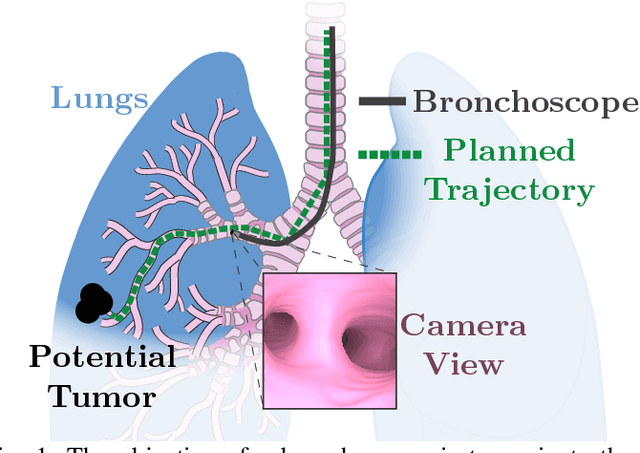 Figure 1 for OffsetNet: Deep Learning for Localization in the Lung using Rendered Images