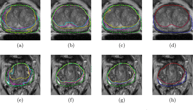 Figure 4 for CNN-based Prostate Zonal Segmentation on T2-weighted MR Images: A Cross-dataset Study