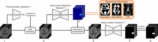 Figure 3 for Asymmetry Disentanglement Network for Interpretable Acute Ischemic Stroke Infarct Segmentation in Non-Contrast CT Scans