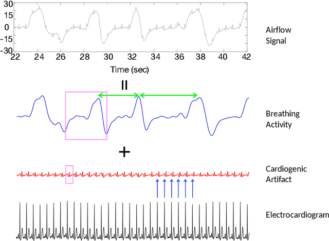Figure 1 for Airflow recovery from thoracic and abdominal movements using Synchrosqueezing Transform and Locally Stationary Gaussian Process Regression