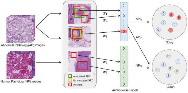 Figure 3 for Decoupled Gradient Harmonized Detector for Partial Annotation: Application to Signet Ring Cell Detection