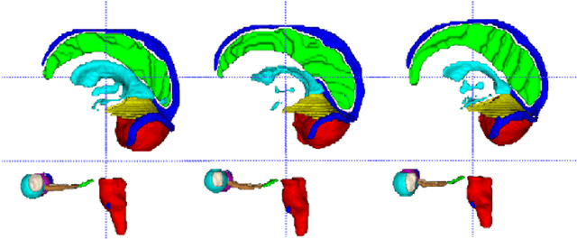 Figure 4 for Ensembled ResUnet for Anatomical Brain Barriers Segmentation