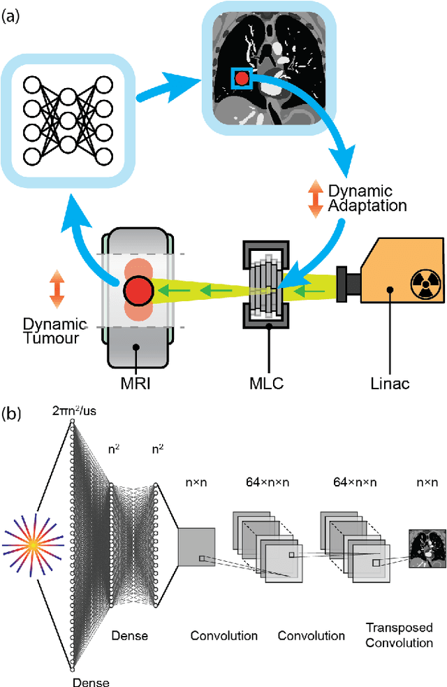 Figure 1 for On Real-time Image Reconstruction with Neural Networks for MRI-guided Radiotherapy