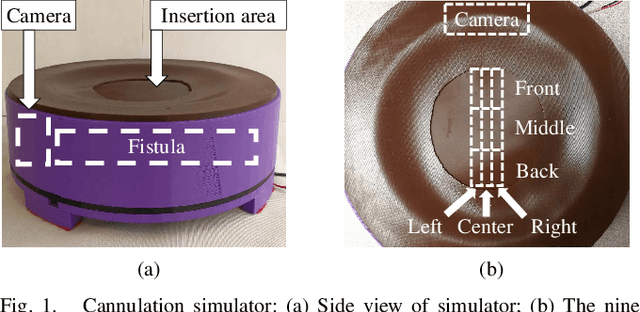 Figure 1 for Deep Learning for Needle Detection in a Cannulation Simulator
