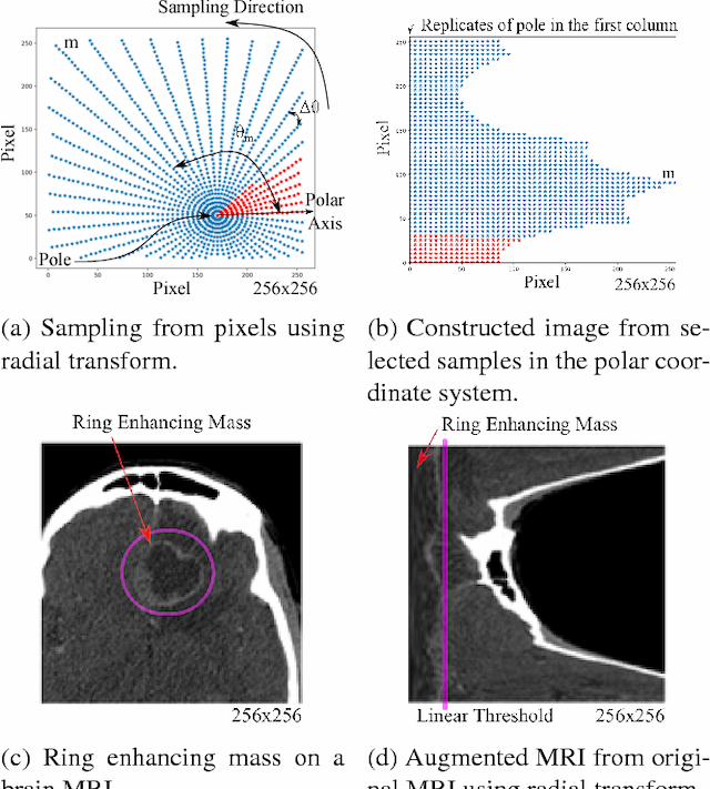 Figure 1 for Image Augmentation using Radial Transform for Training Deep Neural Networks