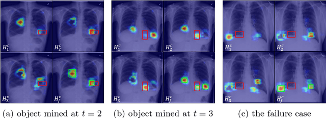 Figure 4 for Iterative Attention Mining for Weakly Supervised Thoracic Disease Pattern Localization in Chest X-Rays