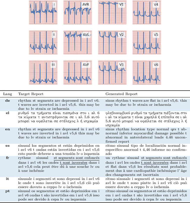 Figure 4 for Let Your Heart Speak in its Mother Tongue: Multilingual Captioning of Cardiac Signals