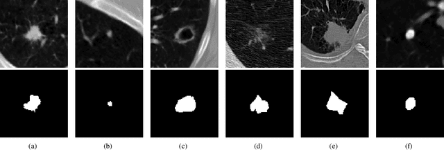 Figure 1 for Accurate 2D soft segmentation of medical image via SoftGAN network