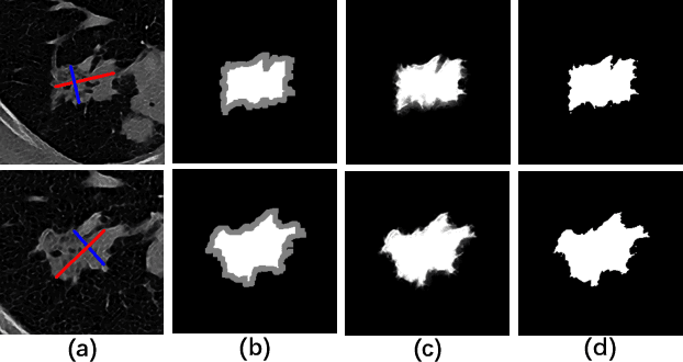 Figure 3 for Accurate 2D soft segmentation of medical image via SoftGAN network