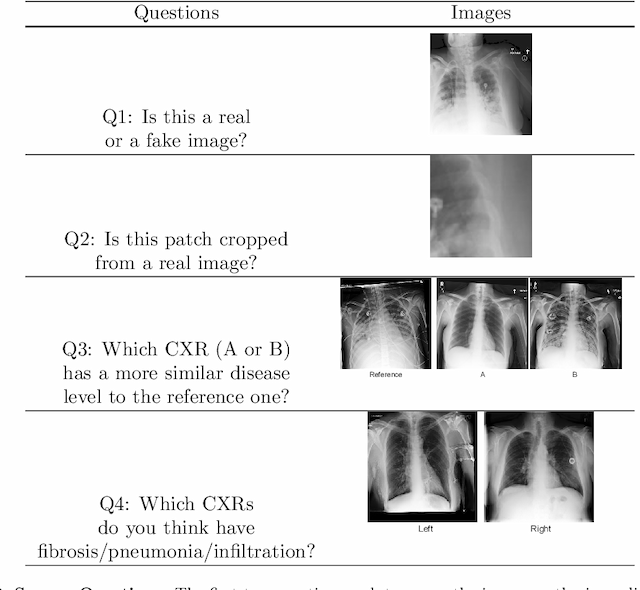 Figure 4 for Lung Swapping Autoencoder: Learning a Disentangled Structure-texture Representation of Chest Radiographs