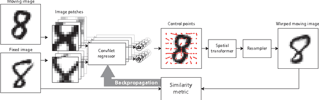Figure 1 for End-to-End Unsupervised Deformable Image Registration with a Convolutional Neural Network
