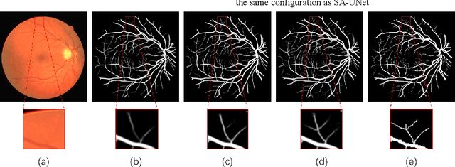 Figure 3 for SA-UNet: Spatial Attention U-Net for Retinal Vessel Segmentation