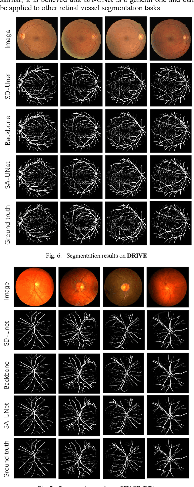 Figure 4 for SA-UNet: Spatial Attention U-Net for Retinal Vessel Segmentation