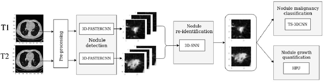 Figure 1 for Detection, growth quantification and malignancy prediction of pulmonary nodules using deep convolutional networks in follow-up CT scans