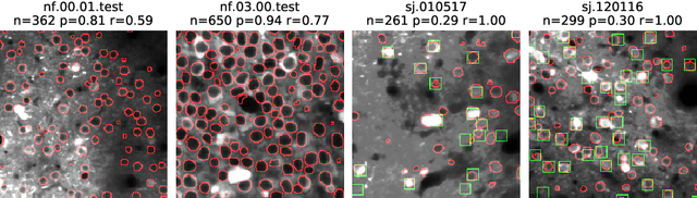 Figure 3 for Fast, Simple Calcium Imaging Segmentation with Fully Convolutional Networks