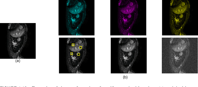 Figure 2 for CapsNet for Medical Image Segmentation