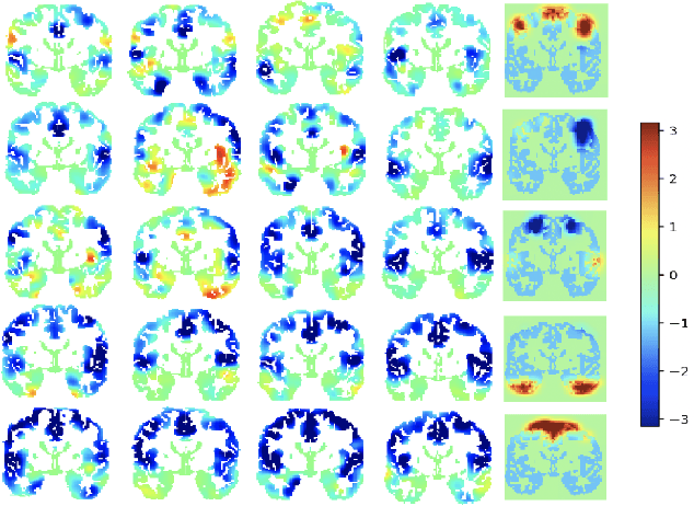 Figure 2 for Exploring latent networks in resting-state fMRI using voxel-to-voxel causal modeling feature selection