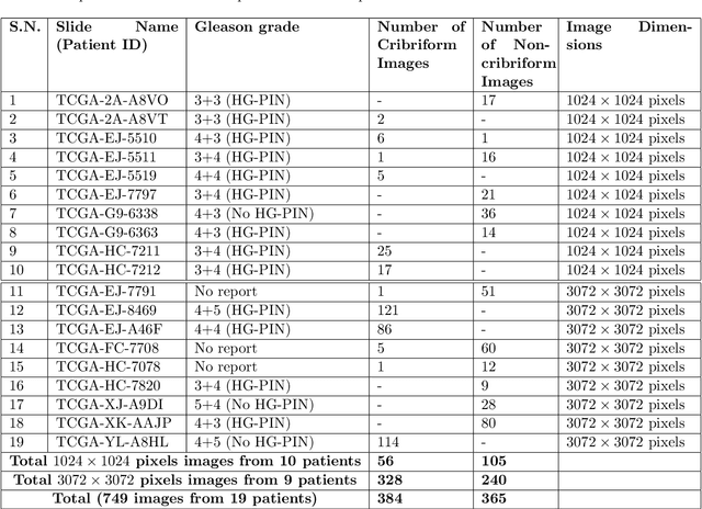 Figure 2 for Cribriform pattern detection in prostate histopathological images using deep learning models