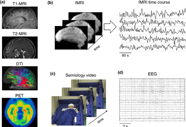 Figure 3 for Machine Learning Applications on Neuroimaging for Diagnosis and Prognosis of Epilepsy: A Review