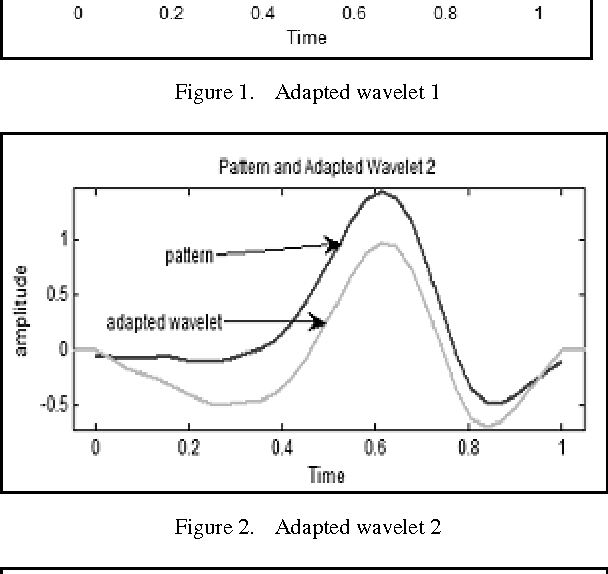 Figure 2 for Methodology For Detection of QRS Pattern Using Secondary Wavelets