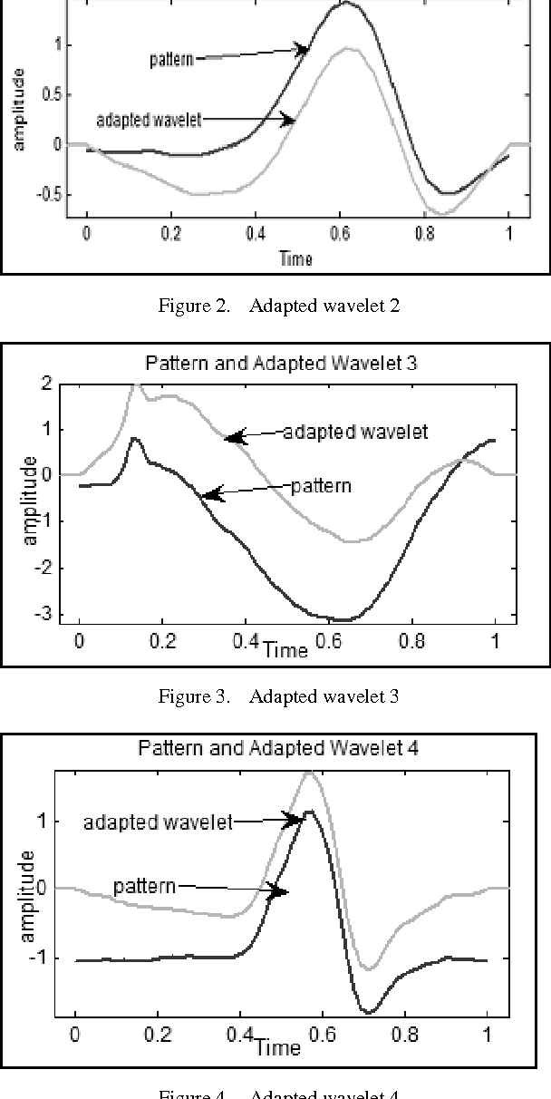 Figure 3 for Methodology For Detection of QRS Pattern Using Secondary Wavelets