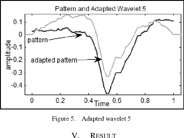 Figure 4 for Methodology For Detection of QRS Pattern Using Secondary Wavelets