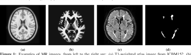 Figure 1 for Brain Atlas Guided Attention U-Net for White Matter Hyperintensity Segmentation