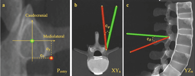 Figure 1 for Sonification as a Reliable Alternative to Conventional Visual Surgical Navigation