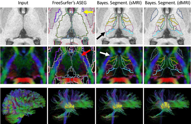 Figure 4 for Joint inference on structural and diffusion MRI for sequence-adaptive Bayesian segmentation of thalamic nuclei with probabilistic atlases