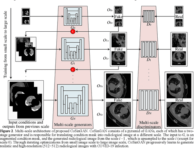 Figure 2 for Learning Diagnosis of COVID-19 from a Single Radiological Image