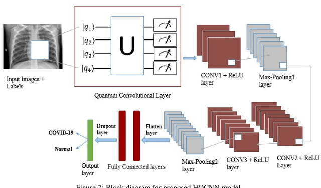 Figure 4 for Hybrid quantum convolutional neural networks model for COVID-19 prediction using chest X-Ray images