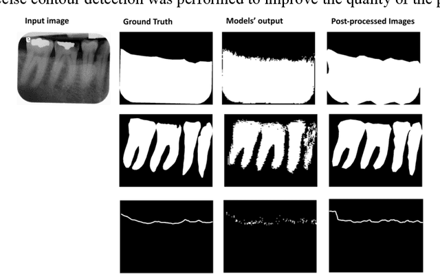 Figure 3 for Use of the Deep Learning Approach to Measure Alveolar Bone Level