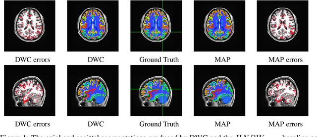 Figure 2 for Distributed Weight Consolidation: A Brain Segmentation Case Study