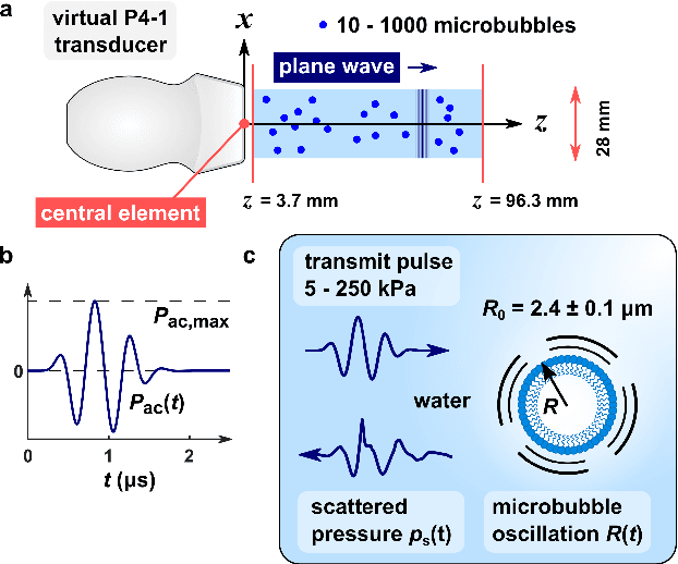 Figure 4 for Super-Resolved Microbubble Localization in Single-Channel Ultrasound RF Signals Using Deep Learning