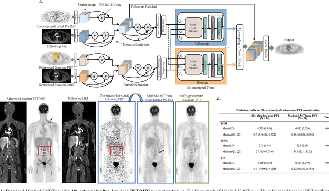 Figure 1 for Masked Co-attentional Transformer reconstructs 100x ultra-fast/low-dose whole-body PET from longitudinal images and anatomically guided MRI