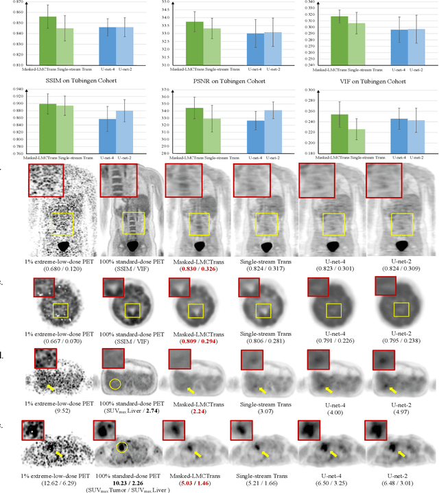 Figure 4 for Masked Co-attentional Transformer reconstructs 100x ultra-fast/low-dose whole-body PET from longitudinal images and anatomically guided MRI
