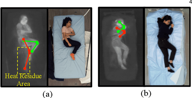 Figure 4 for Simultaneously-Collected Multimodal Lying Pose Dataset: Towards In-Bed Human Pose Monitoring under Adverse Vision Conditions