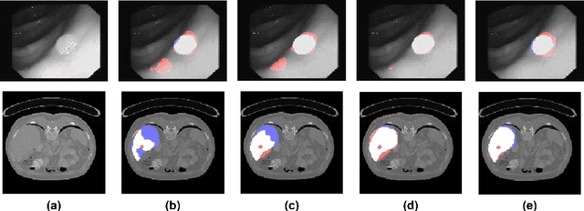 Figure 1 for Spatially Dependent U-Nets: Highly Accurate Architectures for Medical Imaging Segmentation