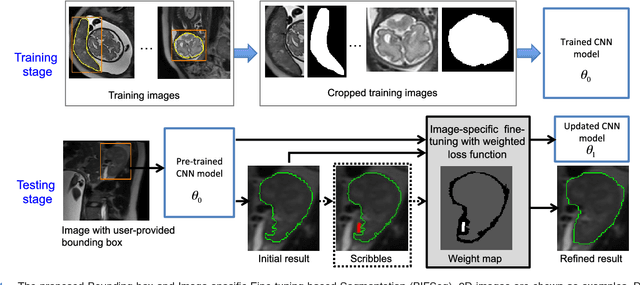 Figure 1 for Interactive Medical Image Segmentation using Deep Learning with Image-specific Fine-tuning