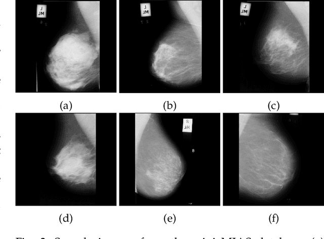 Figure 4 for Use of Transfer Learning and Wavelet Transform for Breast Cancer Detection