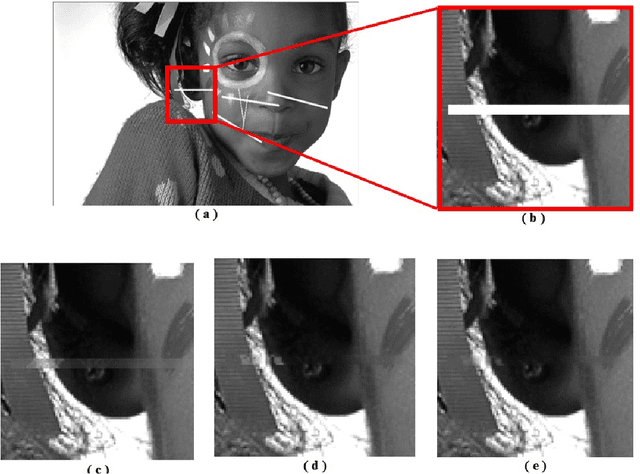 Figure 4 for Image Inpainting by Multiscale Spline Interpolation