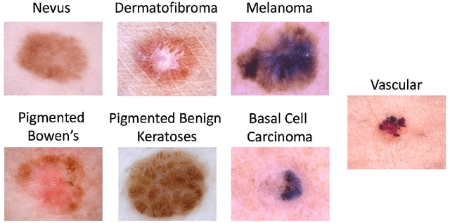 Figure 3 for Few-Shot Classification of Skin Lesions from Dermoscopic Images by Meta-Learning Representative Embeddings