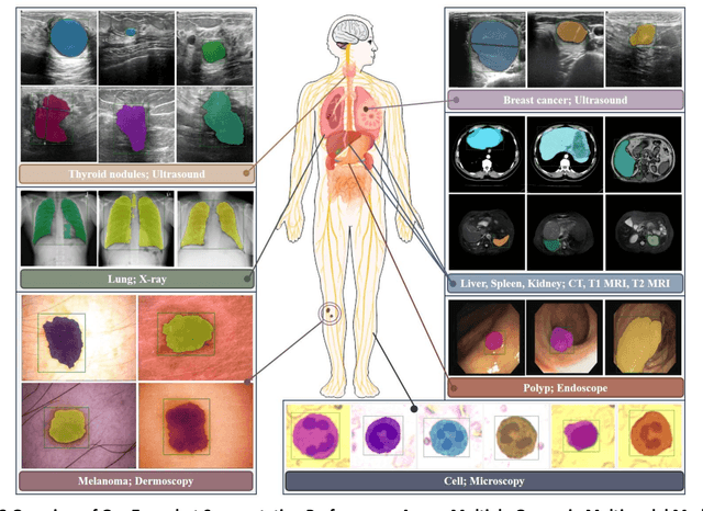 Figure 4 for Increasing SAM Zero-Shot Performance on Multimodal Medical Images Using GPT-4 Generated Descriptive Prompts Without Human Annotation