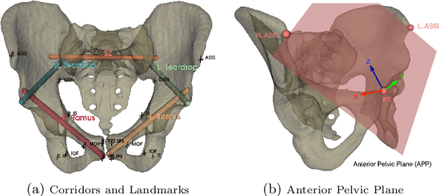 Figure 2 for Pelphix: Surgical Phase Recognition from X-ray Images in Percutaneous Pelvic Fixation