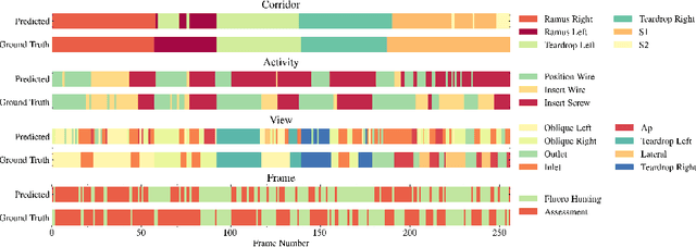 Figure 4 for Pelphix: Surgical Phase Recognition from X-ray Images in Percutaneous Pelvic Fixation