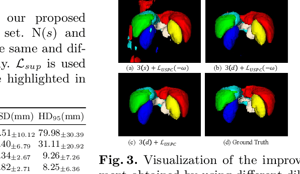Figure 3 for Scribble-based 3D Multiple Abdominal Organ Segmentation via Triple-branch Multi-dilated Network with Pixel- and Class-wise Consistency